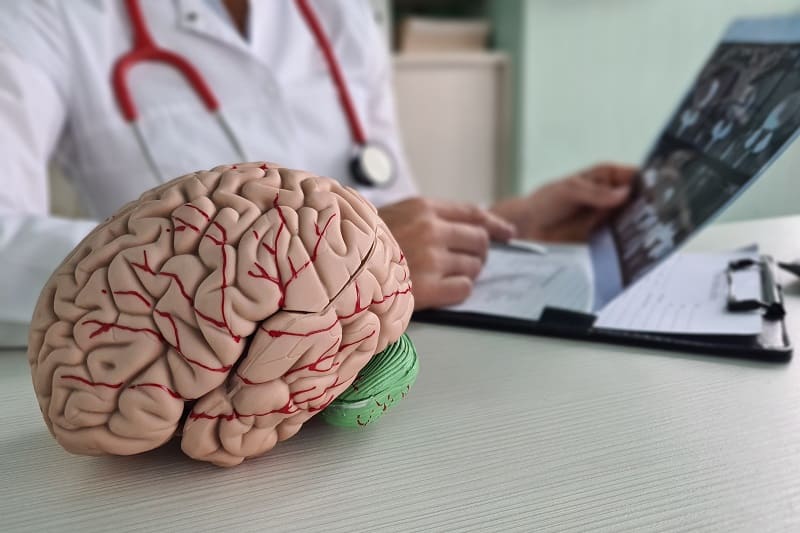 Rehabilitación cognitiva ofrecido por Aliviacare: Mejora tu calidad de vida
